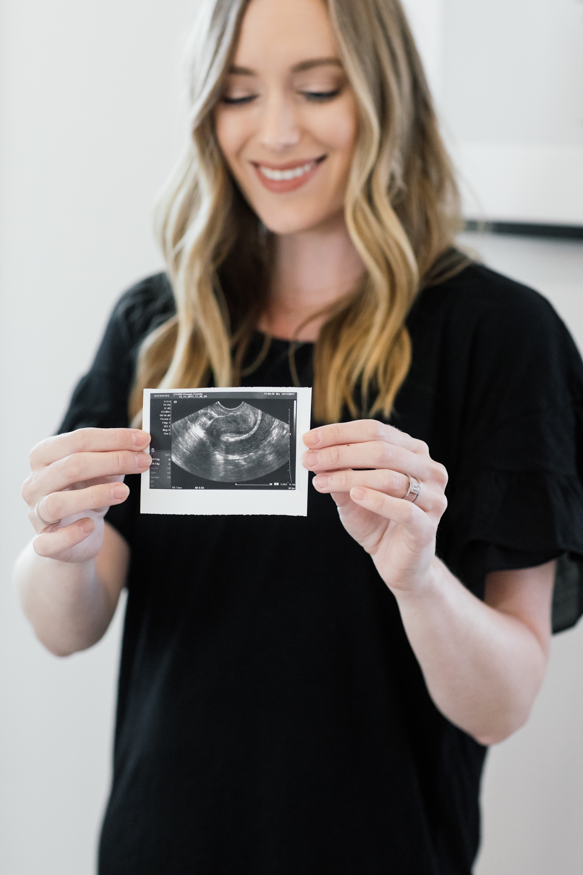eatsleepwear, Kimberly Lapides, LIFESTYLE, IVF, Infertility, FET, Frozen Embryo Transfer, Pregnancy